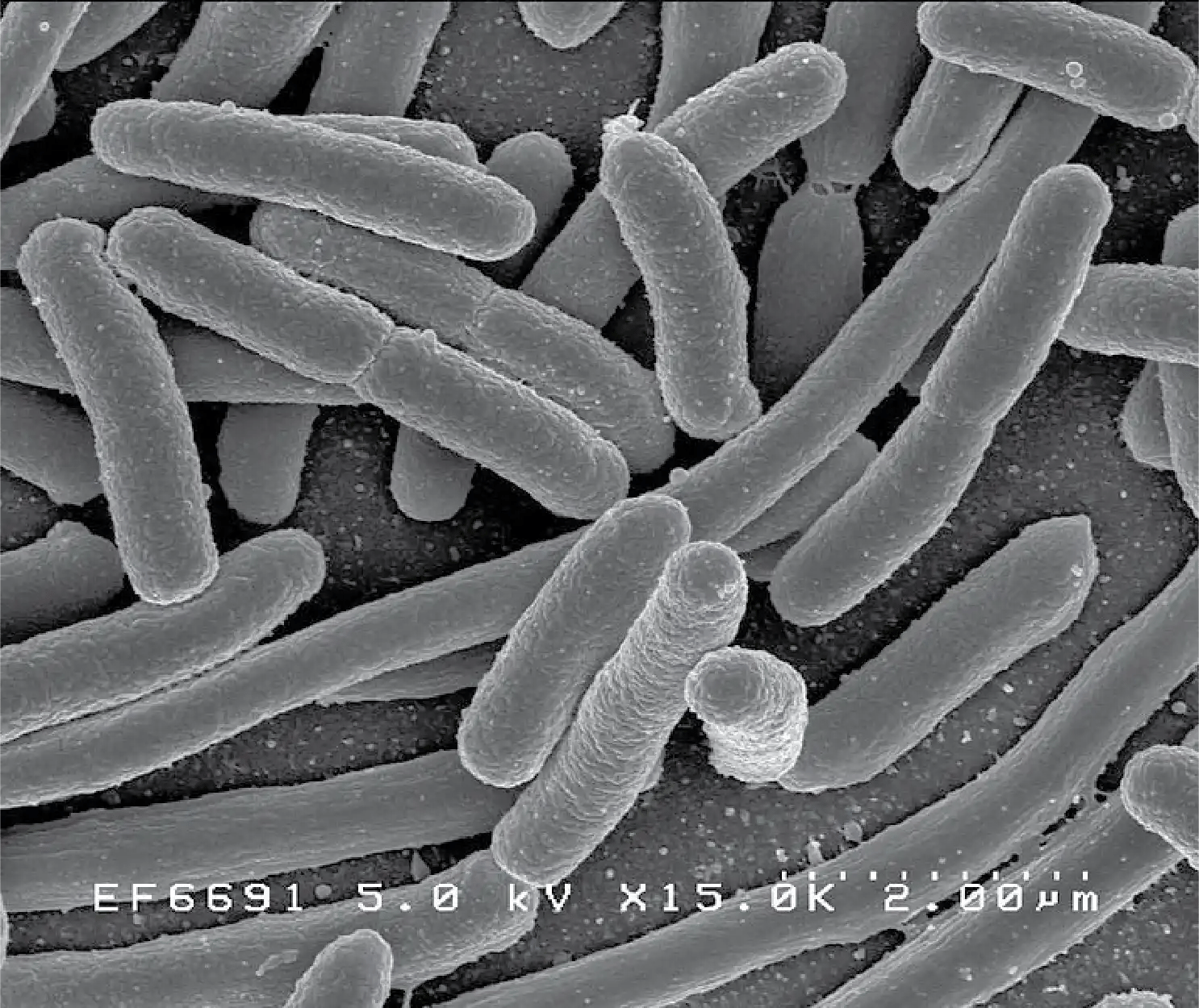 713px-EscherichiaColi_NIAID
